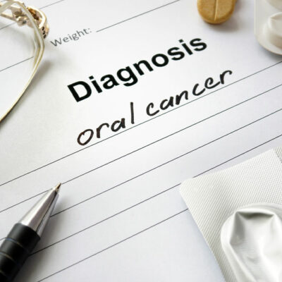 Oral Cancer – Symptoms, Causes and Management Options