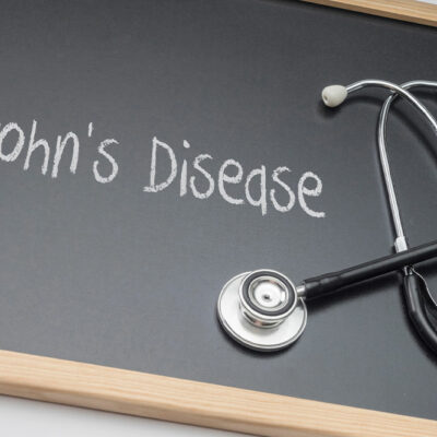 Symptoms, Types, and More About Crohn’s Disease