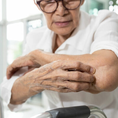 Itchy Skin in Seniors – Causes, Symptoms, and Management